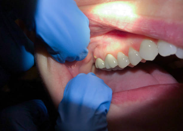 Best Root Canal Emergency Dentist  in White House Station, NJ